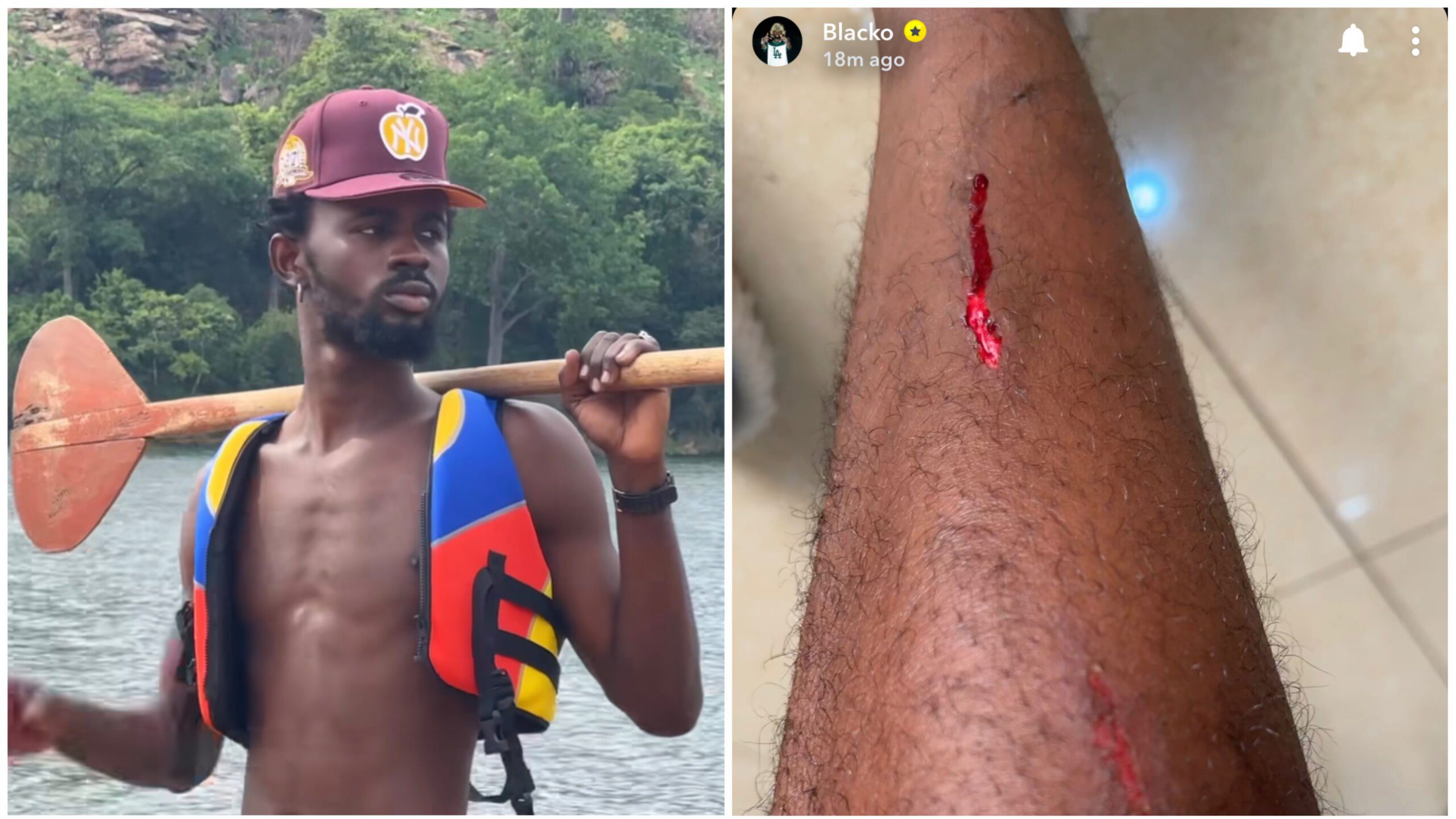 Black Sherif injures himself after blood flows down on his right leg