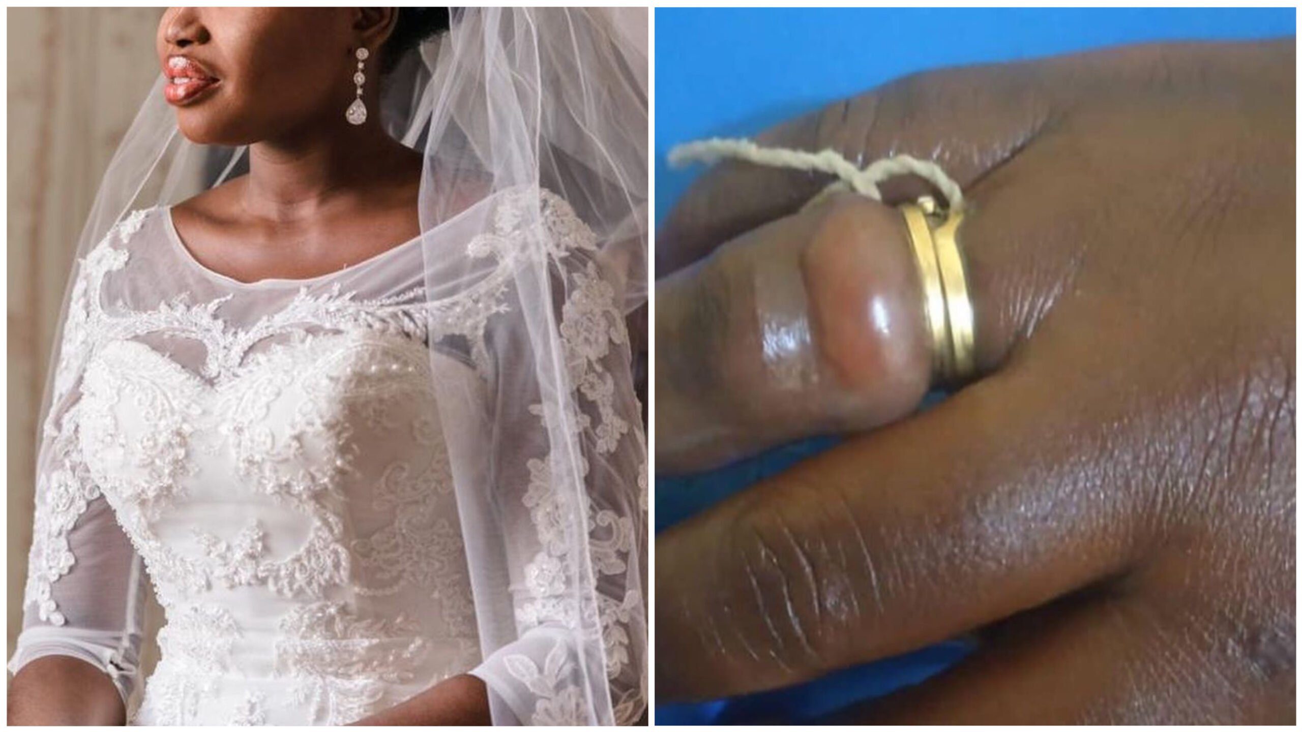 KASOA: Married woman nearly losses her finger after buying wedding ring from friend