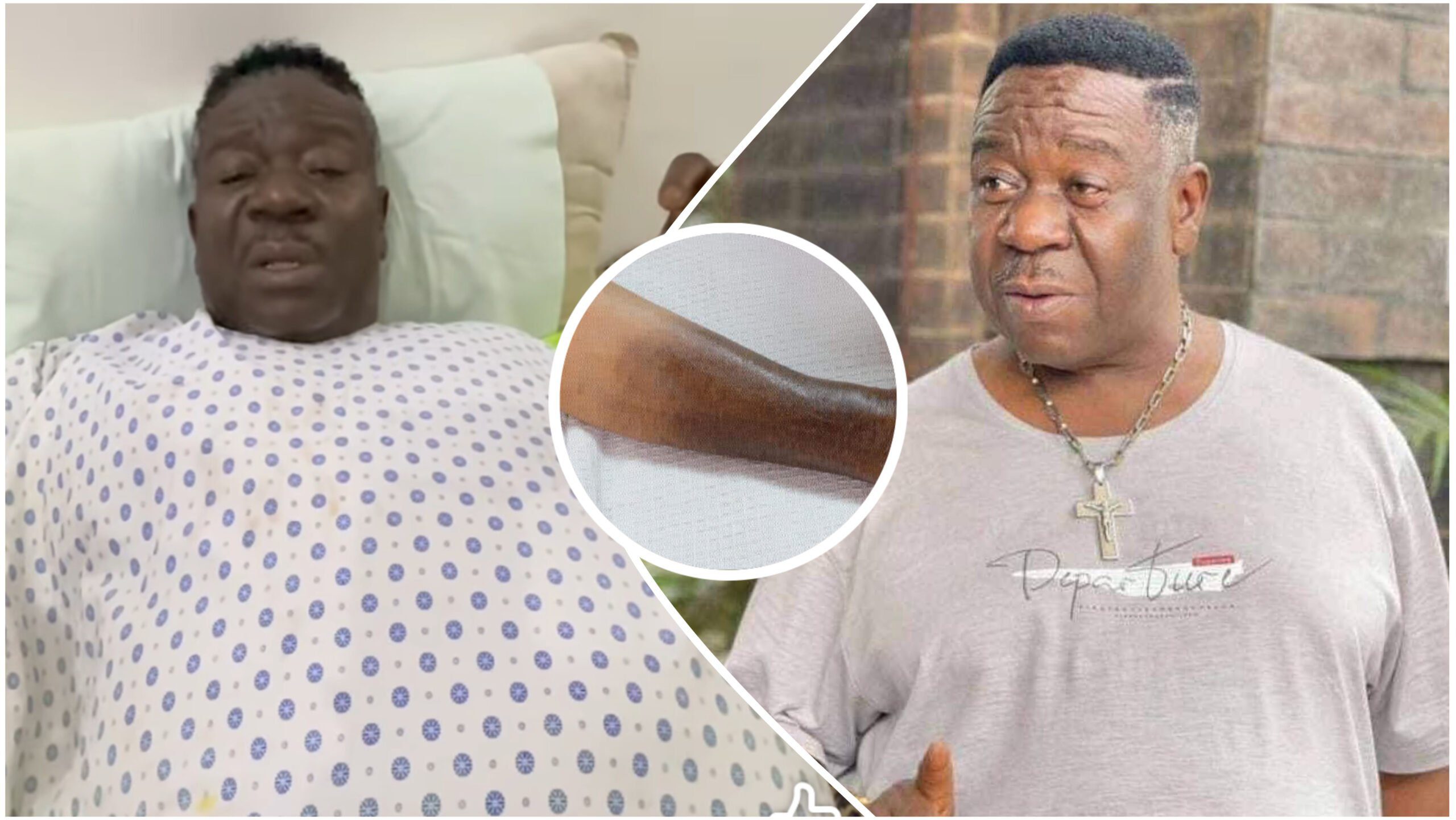 Nigerian veteran actor Mr Ibu’s leg amputated after undergoing seven surgeries