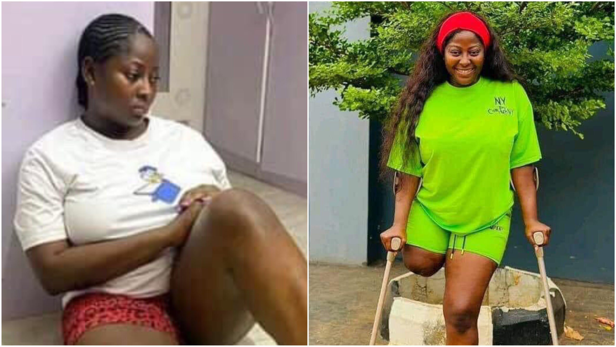 ‘A lot of men date me out of pity’ - Physically challenged Nigerian actress Doris Akonanya reveals (Video)