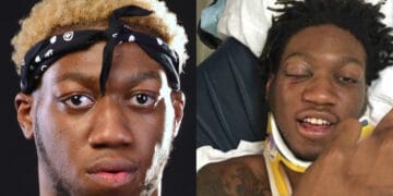 Is OG Maco Dead or Alive?: Rapper Shot Himself in the Head in Suicide Attempt