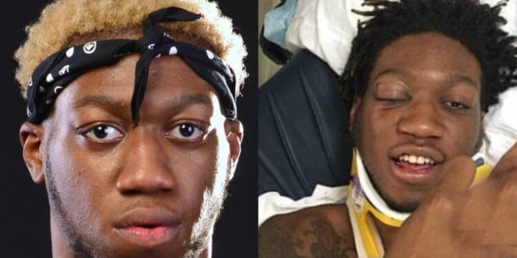 Is OG Maco Dead or Alive?: Rapper Shot Himself in the Head in Suicide Attempt