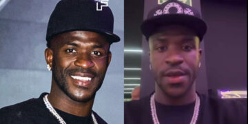 Vinicius Jr. showing his new appearance after a reported chin harmonisation procedure
